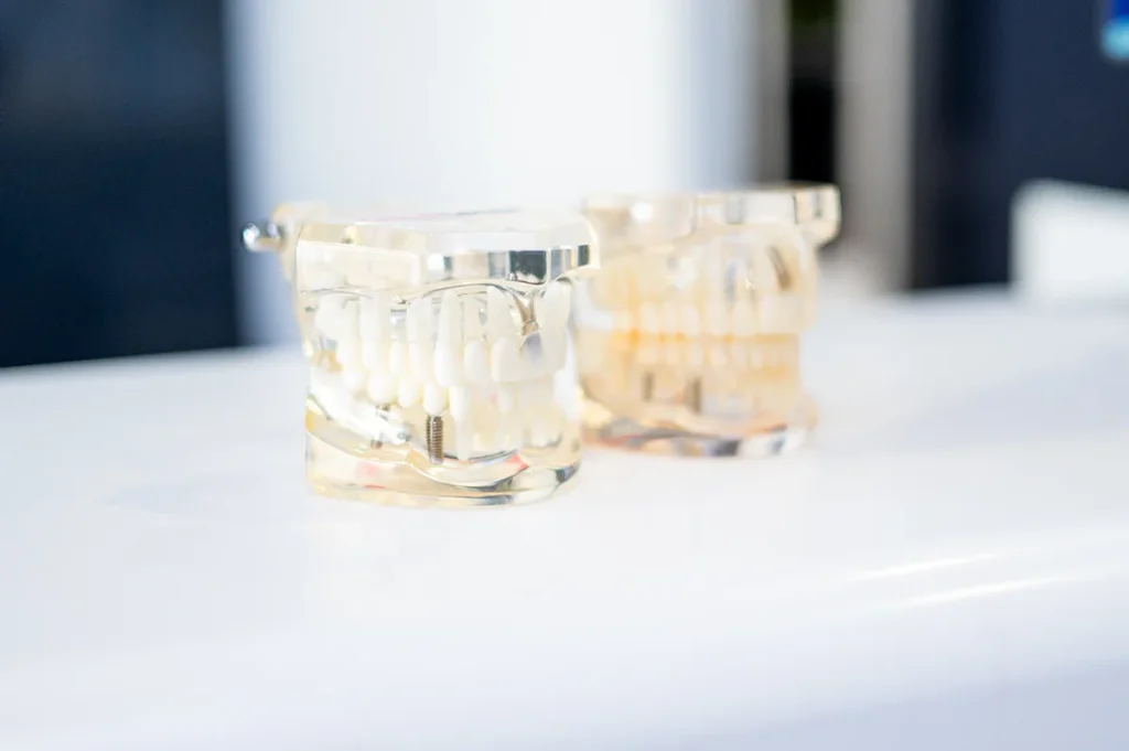 Implantes dentales Valdebebas